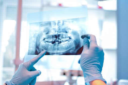 Digital Dental X-rays Centennial Colorado