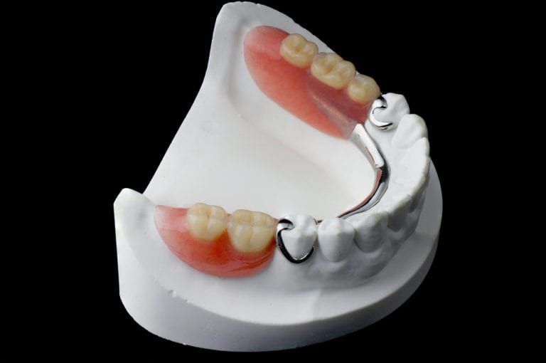 Partial Denture Denver Colorado