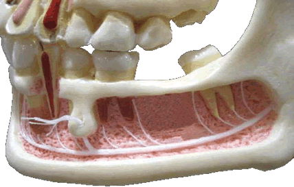 Are Dental Implants Right For Me